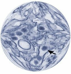 zika virus
